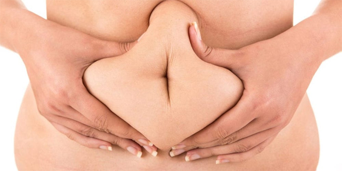 stubborn belly fat treatment