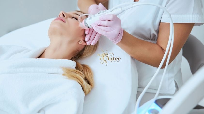 Microneedling Treatments